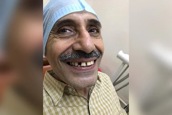 Single Tooth Implant Replacement